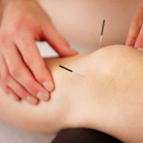 Orthopedic Acupuncture Treatment on Knee