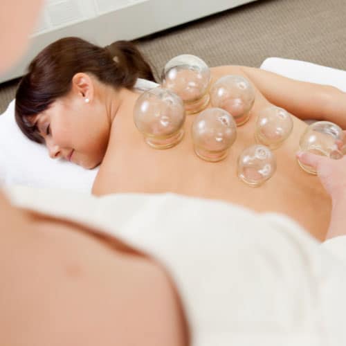 Cupping Treatment