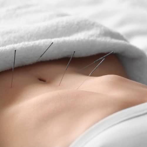 Stomach Acupuncture Treatment