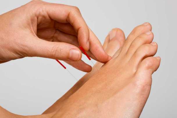 Acupuncture treatment for foot pain