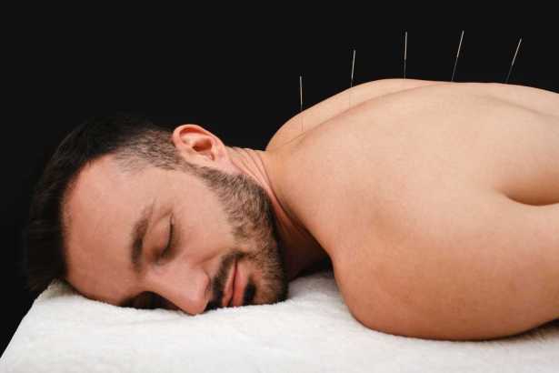 Man receiving relaxing acupuncture treatment